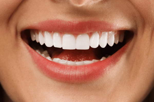 Aesthetic dentistry Smile Centrum