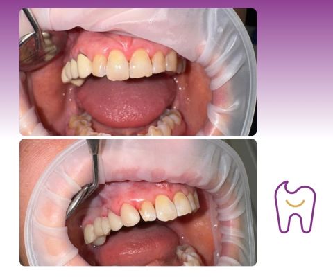 Dental prosthetics Prague